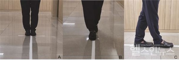 발잇기 일자보행(Tandem gait) 진단법, 경희대의료원 제공