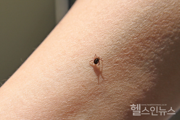쥐 등에 기생하는 털진드기의 유충에 물리면 쯔쯔가무시병에 감염될 수 있다. (사진제공: 클립아트코리아)