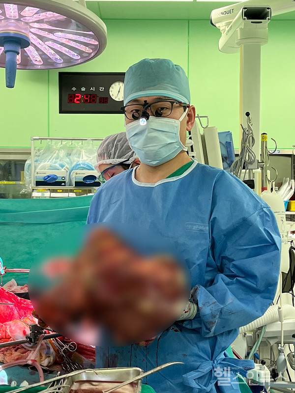 수술을 집도한 세브란스병원 이재근 교수가 수술 당시 환자에게서 제거한 간을 들고 있다.