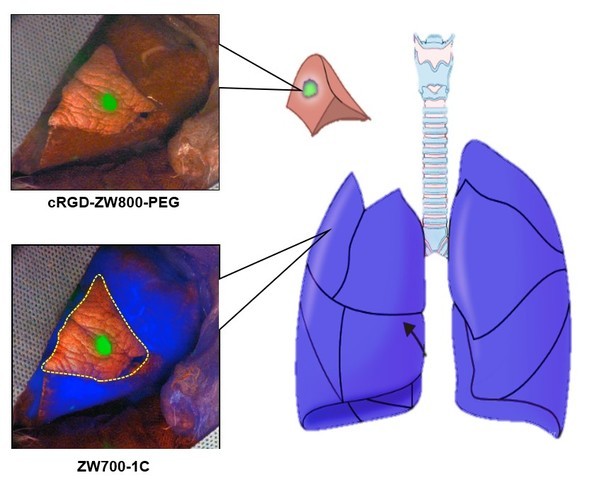 중형동물 폐암모델에서 폐암과 폐구역 경제면을 이중 형광영상을 이용하여 탐색 과정