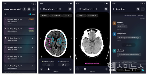 ‘1초라도 더 빨리‘ 휴런, 뇌졸중 선별 AI 모바일앱 출시